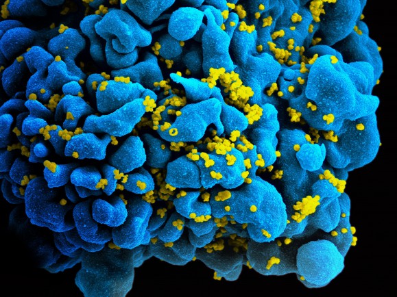Half gay black men will be diagnosed with HIV